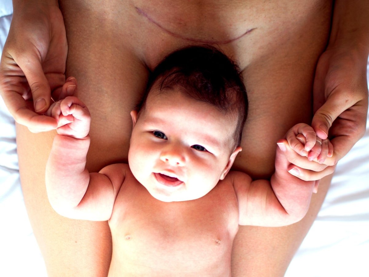 C-Section Recovery Plan: Workout #5 - heal and strengthen your body post C- section, postpartum 