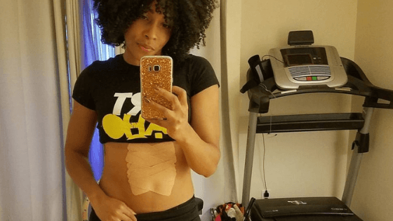 Diastasis Recti Recovery Story with MUTU System - Tatiana