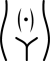 Diastasis